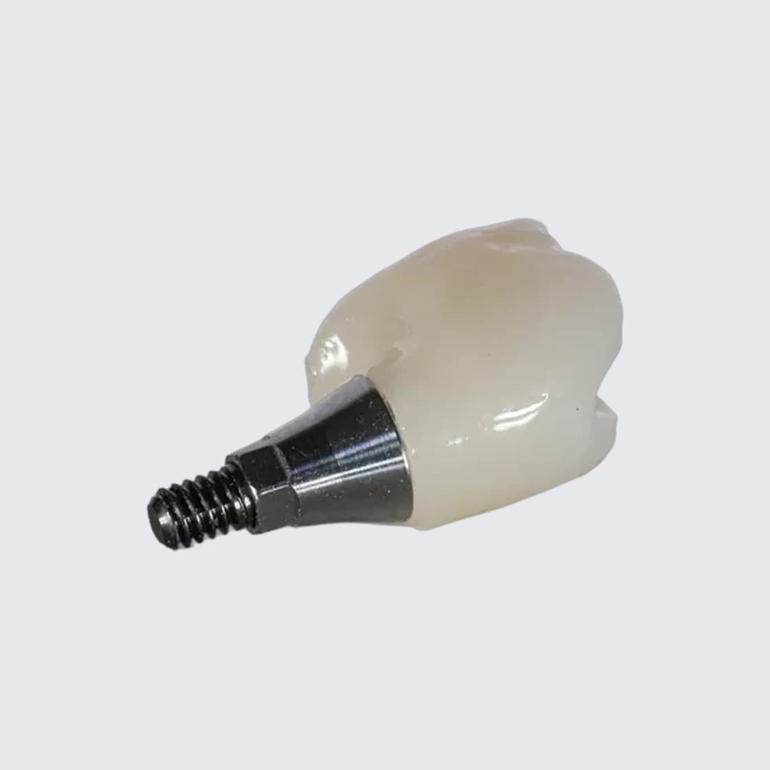 Couronne sur implant montée sur base titane